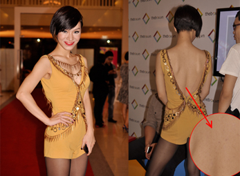 Trà My Idol sexy trước, lộ mụn sau