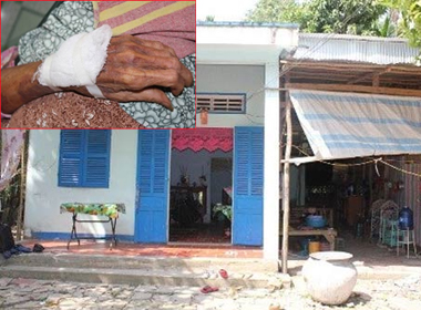 Tay cụ bà bị thương trong khi chống cự 'yêu râu xanh' tại nhà