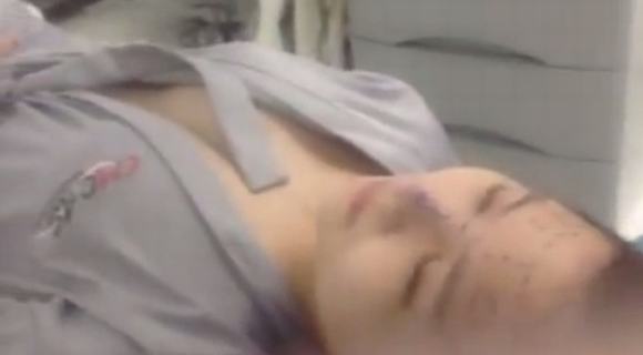 huong-tram-lo-clip-phau-thuat-tham-my8