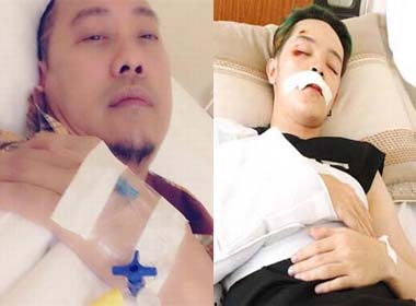 Những sao Việt bị thương nặng sau khi gặp cướp