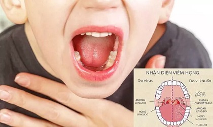 Giao mùa, nếu bố mẹ có thói quen này, con dễ mắc viêm họng và nhiều bệnh nguy hiểm khác Giao mùa, nếu bố mẹ có thói quen này, con dễ mắc viêm họng và nhiều bệnh nguy hiểm khác