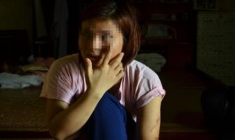 Tâm sự của người phụ nữ sau li hôn vẫn bị chồng đánh nhập viện Tâm sự của người phụ nữ sau li hôn vẫn bị chồng đánh nhập viện