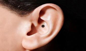 Nốt ruồi mọc ở tai và ở mắt nói lên điều gì? Nốt ruồi mọc ở tai và ở mắt nói lên điều gì?