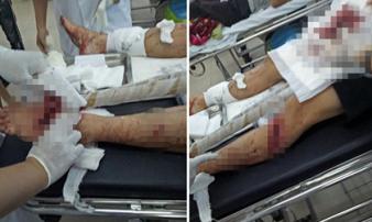 Bênh vợ bị đánh, chồng bị nhóm “giang hồ” chém nhập viện Bênh vợ bị đánh, chồng bị nhóm “giang hồ” chém nhập viện