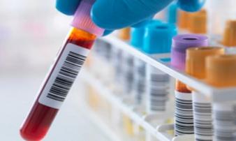 Ca nhiễm HIV được chữa khỏi thứ 3 trên thế giới Ca nhiễm HIV được chữa khỏi thứ 3 trên thế giới
