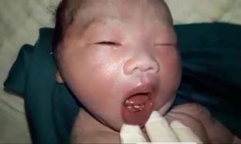 Kỳ lạ bé trai vừa sinh đã mọc răng cửa Kỳ lạ bé trai vừa sinh đã mọc răng cửa