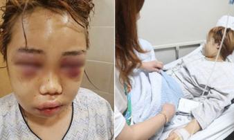 Thêm thông tin chi tiết về vụ nữ sinh 14 tuổi bị bạo hành gây rúng động Hàn Quốc những ngày qua Thêm thông tin chi tiết về vụ nữ sinh 14 tuổi bị bạo hành gây rúng động Hàn Quốc những ngày qua