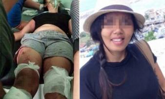 Nghi ngờ vợ lăng nhăng, chồng chém đứt bàn chân vợ trước mặt 2 con nhỏ Nghi ngờ vợ lăng nhăng, chồng chém đứt bàn chân vợ trước mặt 2 con nhỏ