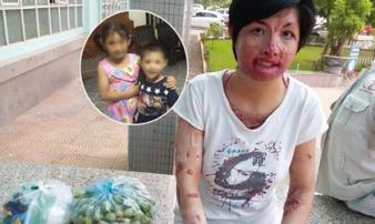 Gặp lại người phụ nữ từng bị chồng nhốt, tẩm xăng thiêu sống: 'Tôi không còn oán hận, chỉ mong có ngày đoàn tụ với con' Gặp lại người phụ nữ từng bị chồng nhốt, tẩm xăng thiêu sống: 'Tôi không còn oán hận, chỉ mong có ngày đoàn tụ với con'