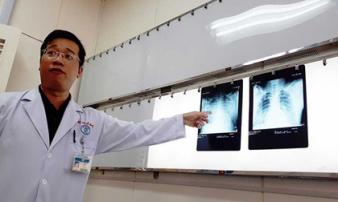 Thực hư virus lạ gây chết người Thực hư virus lạ gây chết người