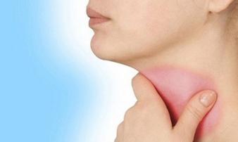 Dấu hiệu sớm của ung thư thực quản Dấu hiệu sớm của ung thư thực quản