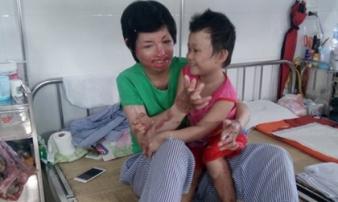 Sự sống tái sinh của cô gái xinh đẹp bị chồng tưới xăng đốt khắp người Sự sống tái sinh của cô gái xinh đẹp bị chồng tưới xăng đốt khắp người
