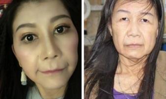 22 tuổi mà bị lão hóa như cụ bà 80, cô gái lột xác nhờ phẫu thuật thẩm mỹ 22 tuổi mà bị lão hóa như cụ bà 80, cô gái lột xác nhờ phẫu thuật thẩm mỹ