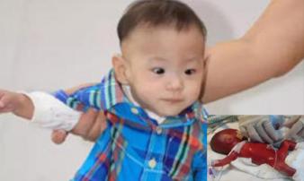 Kỳ tích sống sót của em bé sinh non nhất thế giới, nặng chưa đến 5 lạng, da trong suốt Kỳ tích sống sót của em bé sinh non nhất thế giới, nặng chưa đến 5 lạng, da trong suốt