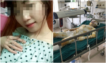 Cô gái bị bạn trai tẩm xăng thiêu sống tại phòng trọ đã qua đời Cô gái bị bạn trai tẩm xăng thiêu sống tại phòng trọ đã qua đời