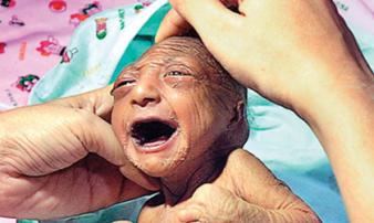 Bố mẹ nhẫn tâm bỏ đói đến chết con gái 2 tuần tuổi vì con có ngoại hình khác thường, may mắn thay vị cứu tinh đã xuất hiện Bố mẹ nhẫn tâm bỏ đói đến chết con gái 2 tuần tuổi vì con có ngoại hình khác thường, may mắn thay vị cứu tinh đã xuất hiện
