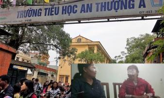 Vụ dâm ô hàng loạt học sinh: Thầy giáo bắt nhiều bạn nữ lên phòng riêng để 'nhổ tóc sâu' Vụ dâm ô hàng loạt học sinh: Thầy giáo bắt nhiều bạn nữ lên phòng riêng để 'nhổ tóc sâu'