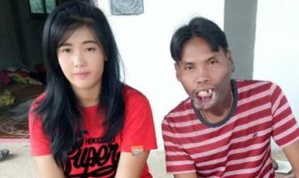 Bất chấp xã hội gièm pha về ngoại hình, cặp đôi 'đũa lệch' vẫn sống vô cùng hạnh phúc Bất chấp xã hội gièm pha về ngoại hình, cặp đôi 'đũa lệch' vẫn sống vô cùng hạnh phúc