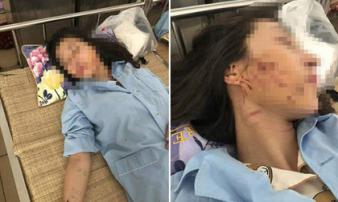 Khởi tố 3 phụ nữ đánh ghen lột đồ, đổ nước mắm, bột ớt lên nữ chủ tiệm spa Khởi tố 3 phụ nữ đánh ghen lột đồ, đổ nước mắm, bột ớt lên nữ chủ tiệm spa