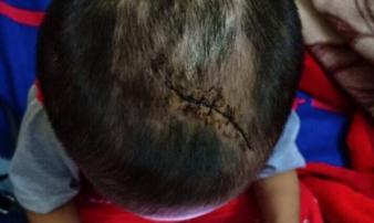Nghi bé trai 3 tuổi bị mẹ ruột cùng cha dượng đánh đập đến thương tích Nghi bé trai 3 tuổi bị mẹ ruột cùng cha dượng đánh đập đến thương tích