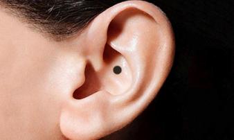 9 nốt ruồi đại phú, đại quý nhất định không được tẩy 9 nốt ruồi đại phú, đại quý nhất định không được tẩy