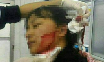 Sau khi rạch mặt và ngực tình trẻ của chồng vẫn phải thừa nhận 'nhìn rất được' Sau khi rạch mặt và ngực tình trẻ của chồng vẫn phải thừa nhận 'nhìn rất được'