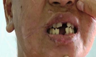 Vụ tra tấn người làm thuê như thời trung cổ: Có thể xem xét 3 tội danh Vụ tra tấn người làm thuê như thời trung cổ: Có thể xem xét 3 tội danh