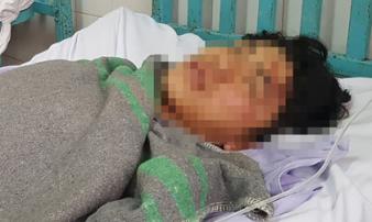 Nhóm côn đồ truy sát 9X trước cổng bệnh viện Nhóm côn đồ truy sát 9X trước cổng bệnh viện