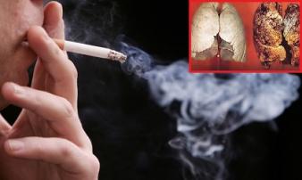 5 thứ nội tạng con người sợ nhất nhưng chúng ta lại vô tư nạp vào cơ thể mỗi ngày 5 thứ nội tạng con người sợ nhất nhưng chúng ta lại vô tư nạp vào cơ thể mỗi ngày