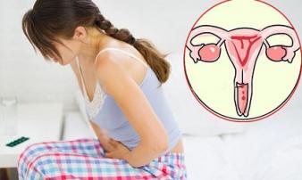 Điểm mặt 5 thói quen xấu và dấu hiệu ung thư cổ tử cung nhiều chị em mắc phải nhưng không hề hay biết Điểm mặt 5 thói quen xấu và dấu hiệu ung thư cổ tử cung nhiều chị em mắc phải nhưng không hề hay biết