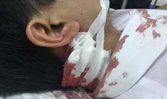 Bị bạn nhậu đánh vào mặt, phản đòn bằng nhát dao vào cổ Bị bạn nhậu đánh vào mặt, phản đòn bằng nhát dao vào cổ