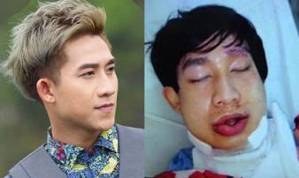 Số phận nghiệt ngã của hot boy rời nhóm HKT đình đám một thời Số phận nghiệt ngã của hot boy rời nhóm HKT đình đám một thời