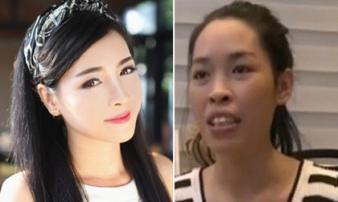 8 ca thẩm mỹ của chị em Việt gây bão dư luận vì biến 'gái xấu thành tiên' 8 ca thẩm mỹ của chị em Việt gây bão dư luận vì biến 'gái xấu thành tiên'