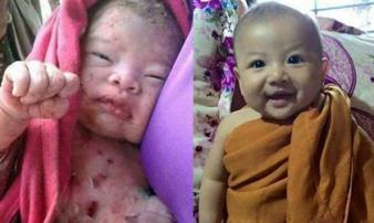 Bé trai sơ sinh bị mẹ đẻ đâm 14 nhát dao rồi chôn sống giờ ra sao? Bé trai sơ sinh bị mẹ đẻ đâm 14 nhát dao rồi chôn sống giờ ra sao?