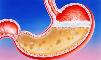 Muốn bảo vệ dạ dày không bị gặm nhấm nhất định phải tránh thật xa 6 loại thực phẩm này Muốn bảo vệ dạ dày không bị gặm nhấm nhất định phải tránh thật xa 6 loại thực phẩm này