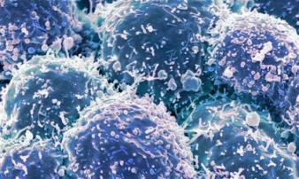 Chế tạo thành công loại virus chuyên diệt tế bào ung thư Chế tạo thành công loại virus chuyên diệt tế bào ung thư
