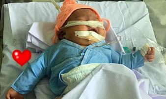 Bé gái sơ sinh 4kg bị gãy tay, nguy kịch vì bác sĩ đỡ đẻ sai cách Bé gái sơ sinh 4kg bị gãy tay, nguy kịch vì bác sĩ đỡ đẻ sai cách