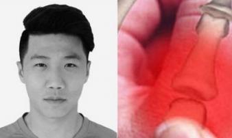 Mới 23 tuổi, cầu thủ bóng đá qua đời vì ung thư, cẩn thận khi vận động quá mức Mới 23 tuổi, cầu thủ bóng đá qua đời vì ung thư, cẩn thận khi vận động quá mức