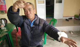 Người lao vào lửa cứu nạn nhân vụ con gái ôm mẹ tự thiêu kể lại phút giây sinh tử Người lao vào lửa cứu nạn nhân vụ con gái ôm mẹ tự thiêu kể lại phút giây sinh tử