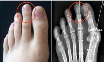 4 nét tướng chân phú quý của người phụ nữ cứ đi 1 bước lại giàu thêm 1 bậc 4 nét tướng chân phú quý của người phụ nữ cứ đi 1 bước lại giàu thêm 1 bậc
