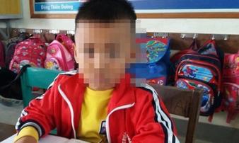 Chép nhầm đề, học sinh lớp 1 bị cô chủ nhiệm tát nhập viện Chép nhầm đề, học sinh lớp 1 bị cô chủ nhiệm tát nhập viện
