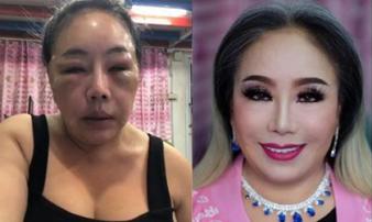 Sau nhiều cuộc trùng tu, nhan sắc của đại gia 60 tuổi 14 đời chồng khiến nhiều người… bật ngửa Sau nhiều cuộc trùng tu, nhan sắc của đại gia 60 tuổi 14 đời chồng khiến nhiều người… bật ngửa