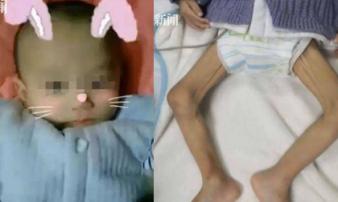 Bé sơ sinh chào đời 4,4kg nhưng sau một năm không ai nhận ra, nguyên nhân quá đáng sợ Bé sơ sinh chào đời 4,4kg nhưng sau một năm không ai nhận ra, nguyên nhân quá đáng sợ