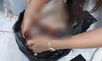 Em bé sơ sinh nghi bị mẹ đẻ xong rồi bỏ vào túi nylon vứt ở nhà vệ sinh công ty, bé đã tử vong Em bé sơ sinh nghi bị mẹ đẻ xong rồi bỏ vào túi nylon vứt ở nhà vệ sinh công ty, bé đã tử vong