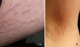 Cậu bé 14 tuổi suýt sát hại cả nhà, nguyên nhân từ một vết xước không ai ngờ tới Cậu bé 14 tuổi suýt sát hại cả nhà, nguyên nhân từ một vết xước không ai ngờ tới