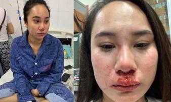 Cô gái bị 'đánh ghen', lột đồ ở Hà Nội: Do cạnh tranh bán hàng online? Cô gái bị 'đánh ghen', lột đồ ở Hà Nội: Do cạnh tranh bán hàng online?