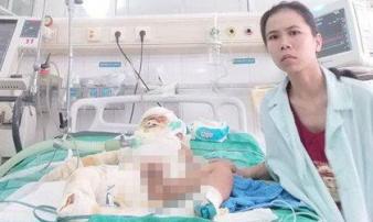 Mua xăng về nhà dùng chưa hết, mẹ Ninh Bình “ôm hận” khi 2 con thành mồi lửa Mua xăng về nhà dùng chưa hết, mẹ Ninh Bình “ôm hận” khi 2 con thành mồi lửa