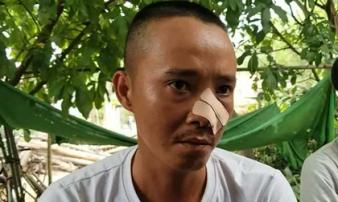 Nhóm thanh niên đến tận nhà truy sát 3 cha con: Lời kể của nạn nhân Nhóm thanh niên đến tận nhà truy sát 3 cha con: Lời kể của nạn nhân