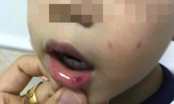 Lá thư xin lỗi gửi lúc đêm muộn của cô giáo ở Hà Nội tát bé hơn 2 tuổi sấp mặt, tụ máu môi Lá thư xin lỗi gửi lúc đêm muộn của cô giáo ở Hà Nội tát bé hơn 2 tuổi sấp mặt, tụ máu môi