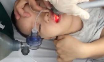 7 phút sinh tử cứu bé trai 21 tháng tuổi bị hóc thạch rau câu 7 phút sinh tử cứu bé trai 21 tháng tuổi bị hóc thạch rau câu